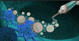 ¿Qué son las vacunas terapéuticas?